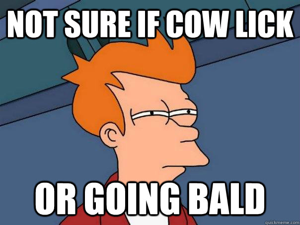 Not sure if cow lick Or going bald  Futurama Fry