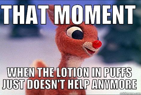 THAT MOMENT  WHEN THE LOTION IN PUFFS JUST DOESN'T HELP ANYMORE Condescending Rudolph
