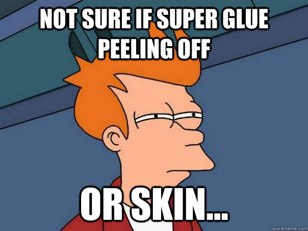 Not sure if super glue peeling off or skin...  Futurama Fry