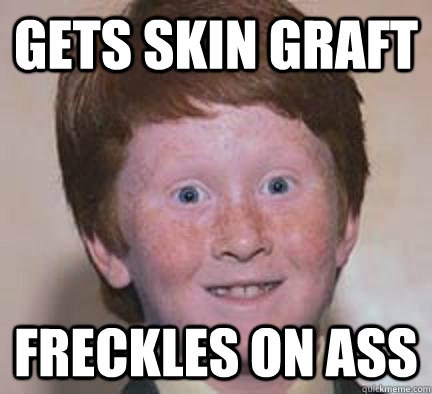 Gets skin graft Freckles on ass  Over Confident Ginger