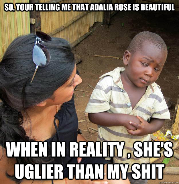 So, your telling me that adalia rose is beautiful when in reality , she's uglier than my shit  Skeptical African Kid