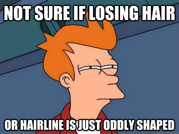 Not sure if losing hair Or hairline is just oddly shaped  Futurama Fry