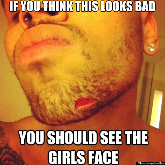 IF you think this looks bad You should see the girls face  Chris Brown
