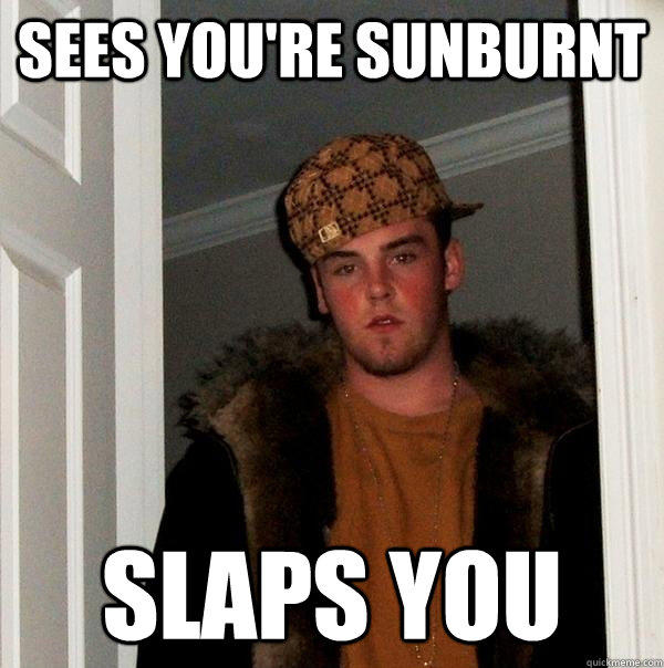 Sees you're sunburnt slaps you  