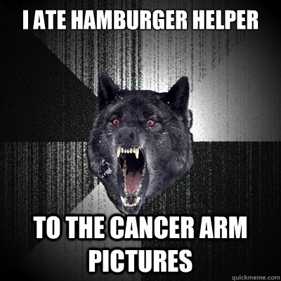 I ATE HAMBURGER HELPER TO THE CANCER ARM PICTURES  Bullets - Insanity wolf