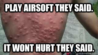 play airsoft they said. it wont hurt they said.  airsoft
