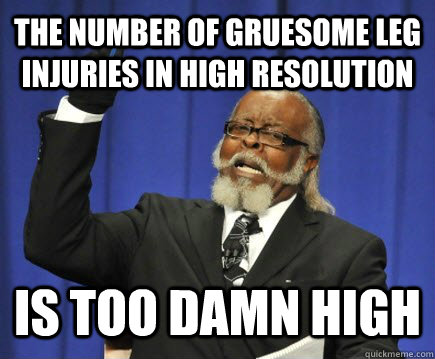 The number of Gruesome leg injuries in High resolution is too damn high  Too Damn High