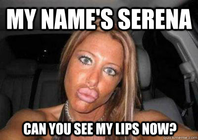 my name's serena can you see my lips now? - my name's serena can you see my lips now?  Duck lips