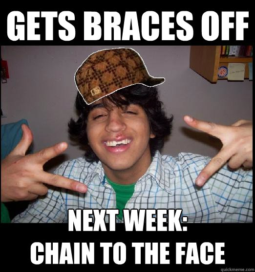 Gets braces off Next week: 
Chain to the face - Gets braces off Next week: 
Chain to the face  Misc