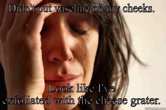 DIDN'T PUT VASELINE ON MY CHEEKS. LOOK LIKE I'VE EXFOLIATED WITH THE CHEESE GRATER. First World Problems