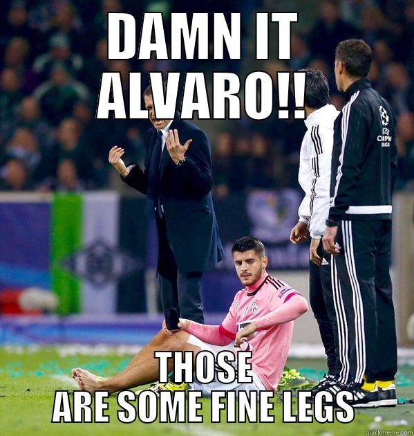 DAMN IT ALVARO!! THOSE ARE SOME FINE LEGS Misc