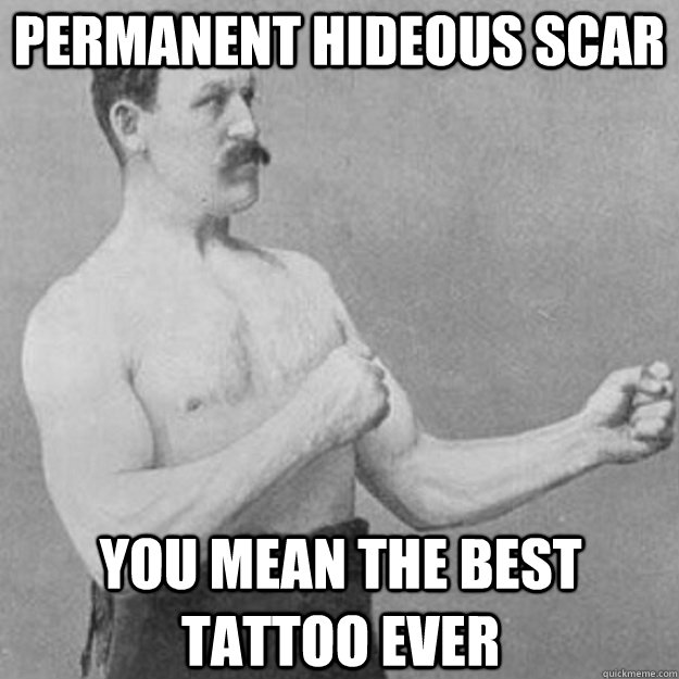 Permanent hideous scar You mean the best tattoo ever  overly manly man