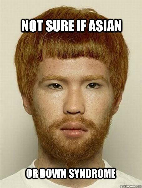 Not sure if asian or down syndrome  - Not sure if asian or down syndrome   Misc