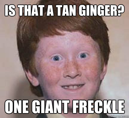is that a tan ginger? one giant freckle - is that a tan ginger? one giant freckle  Over Confident Ginger