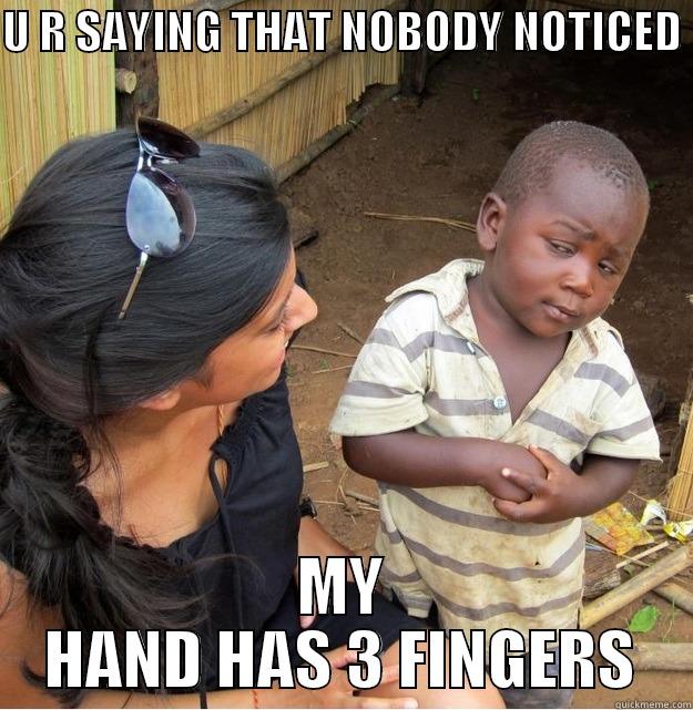 U R SAYING THAT NOBODY NOTICED  MY HAND HAS 3 FINGERS Skeptical Third World Kid