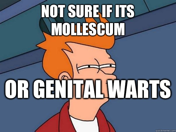 Not sure if its mollescum  Or genital warts   Futurama Fry