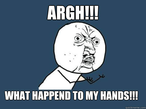 Argh!!! what happend to my hands!!!  Y U No