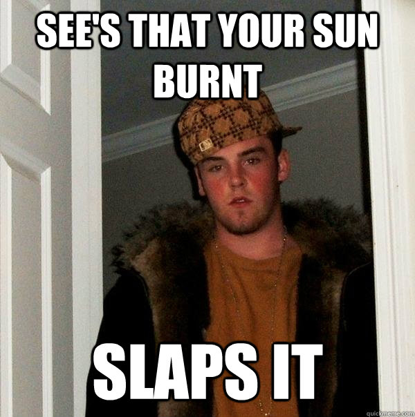 see's that your sun burnt slaps it  Scumbag Steve