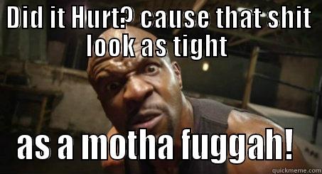 DID IT HURT? CAUSE THAT SHIT LOOK AS TIGHT  AS A MOTHA FUGGAH!  Misc