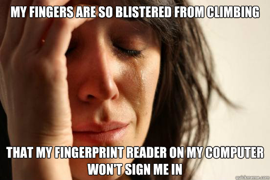 My fingers are so blistered from climbing  That my fingerprint reader on my computer won't sign me in  First World Problems