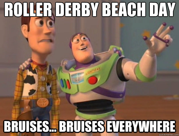 roller derby beach day bruises... bruises everywhere  Toy Story