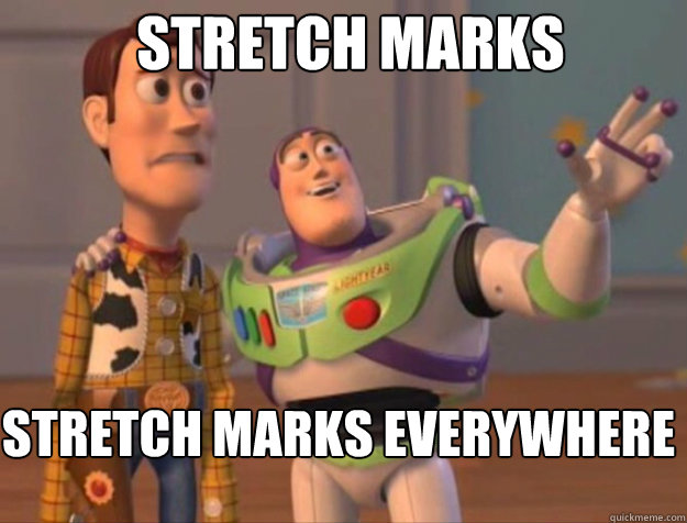 Stretch marks stretch marks everywhere  - Stretch marks stretch marks everywhere   buzz woody