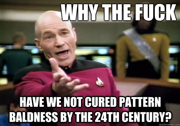                 Why the fuck have we not cured pattern baldness by the 24th century?  Why The Fuck Picard