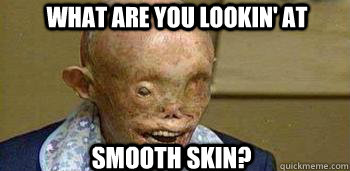 What are you lookin' at Smooth Skin?  Atom Bomb Survivor