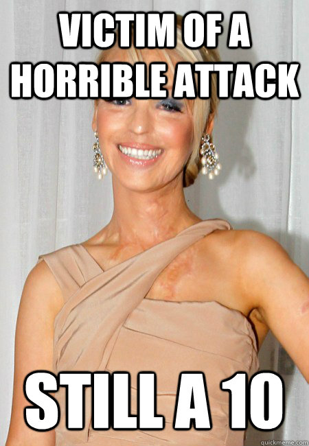 Victim of a horrible Attack Still a 10 - Victim of a horrible Attack Still a 10  Misc
