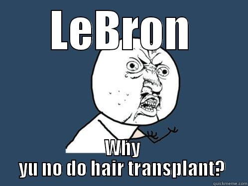 LEBRON WHY YU NO DO HAIR TRANSPLANT? Y U No