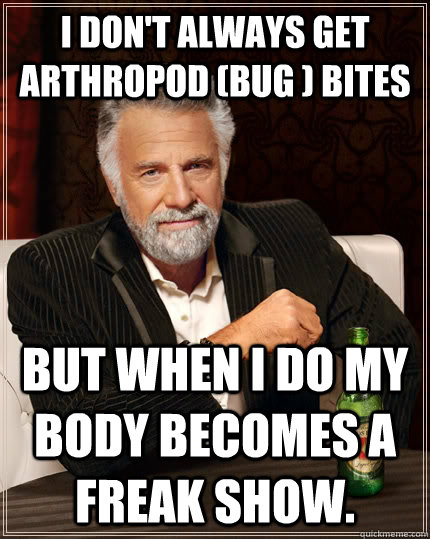 I don't always get arthropod (bug ) bites but when I do my body becomes a freak show. - I don't always get arthropod (bug ) bites but when I do my body becomes a freak show.  The Most Interesting Man In The World
