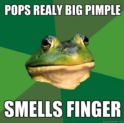 Pops realy big pimple Smells finger  Foul Bachelor Frog