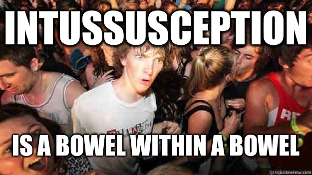 Intussusception Is a bowel within a bowel  Sudden Clarity Clarence