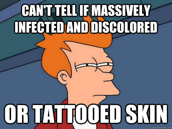 Can't tell if massively infected and discolored or tattooed skin - Can't tell if massively infected and discolored or tattooed skin  Futurama Fry