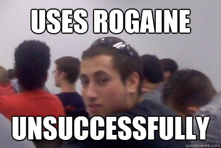 uses rogaine unsuccessfully   