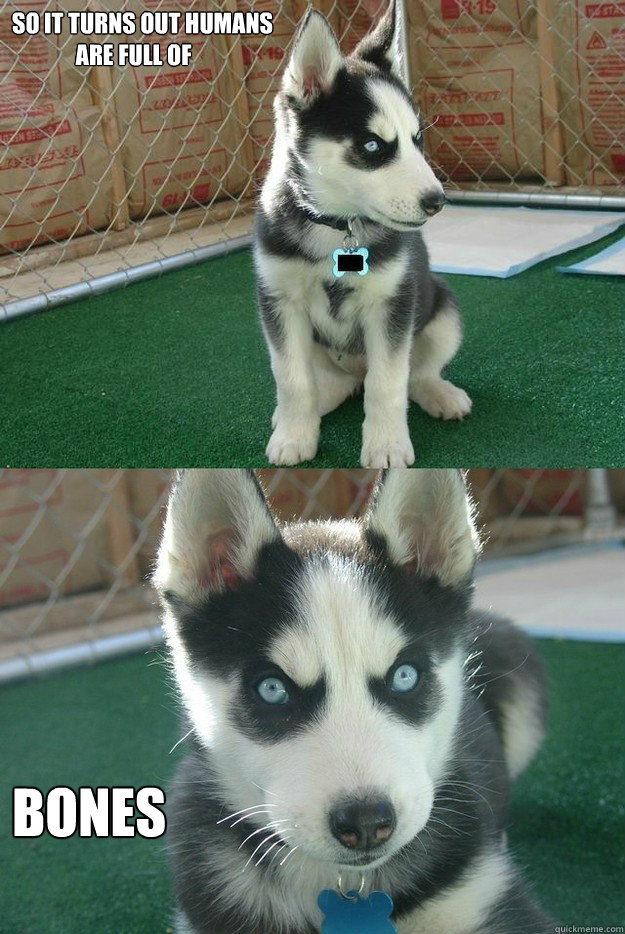 So it turns out humans
              are full of Bones - So it turns out humans
              are full of Bones  Insanity puppy