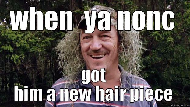 WHEN  YA NONC GOT HIM A NEW HAIR PIECE Misc