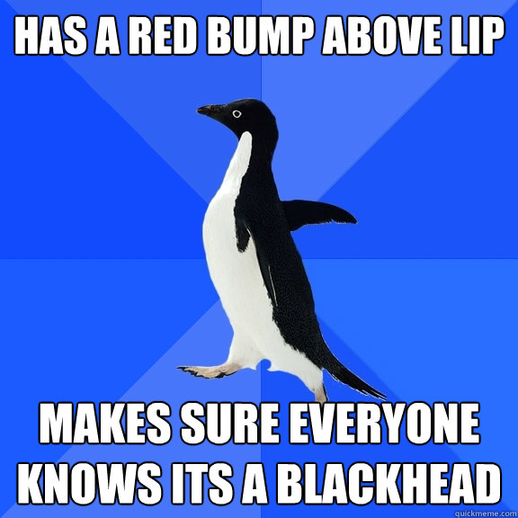 has a red bump above lip makes sure everyone knows its a blackhead  Socially Awkward Penguin