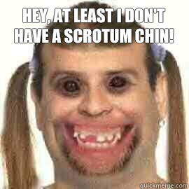 Hey, at least I don't have a scrotum chin!   