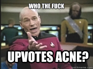 Who the fuck upvotes acne?  Annoyed Picard