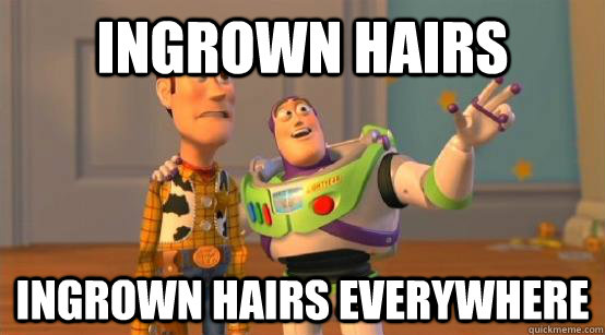 ingrown hairs ingrown hairs everywhere  Buzz Glitter