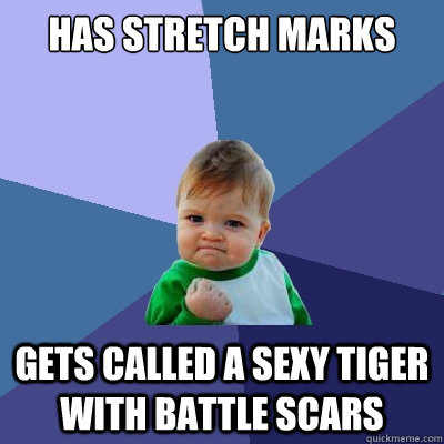 Has stretch marks gets called a sexy tiger with battle scars  Success Kid