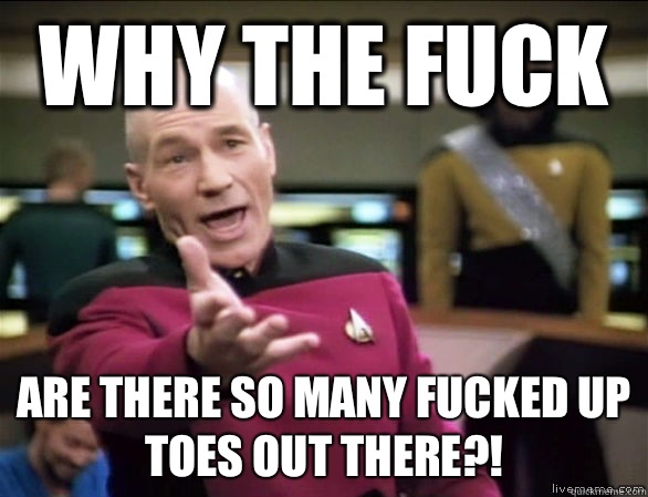 why the fuck Are there so many fucked up toes out there?!  Annoyed Picard HD