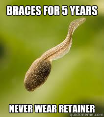 braces for 5 years never wear retainer - braces for 5 years never wear retainer  Crapdong