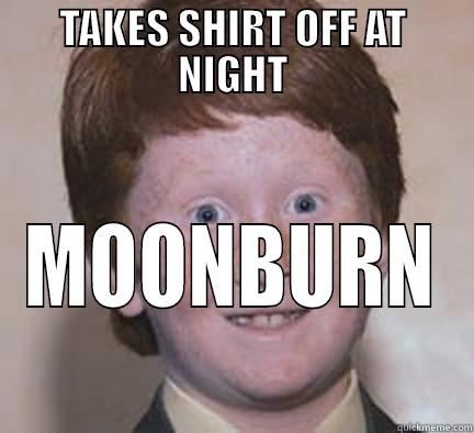 TAKES SHIRT OFF AT NIGHT MOONBURN Over Confident Ginger