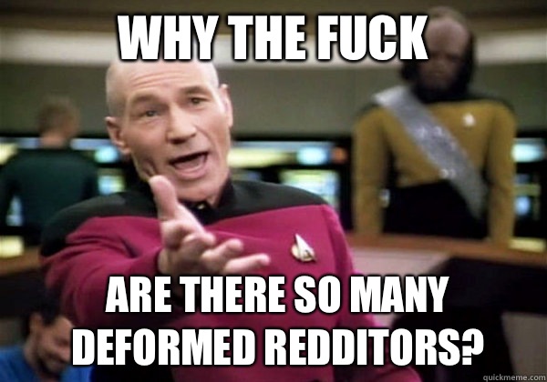 Why the fuck Are there so many deformed redditors?  Patrick Stewart WTF