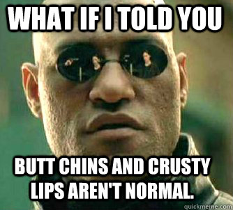 what if i told you Butt chins and crusty lips aren't normal.  Matrix Morpheus