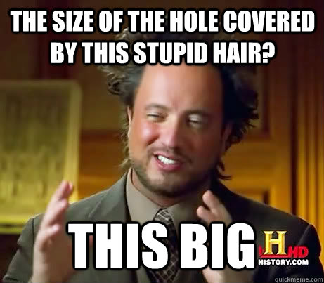 The size of the hole covered by this stupid hair? This big  Giorgio A Tsoukalos