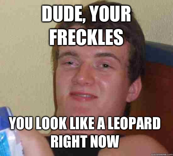 Dude, your freckles You look like a leopard right now  10 Guy