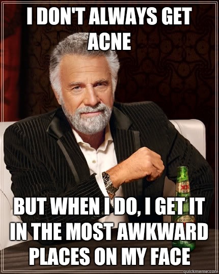 I don't always get acne but when i do, i get it in the most awkward places on my face - I don't always get acne but when i do, i get it in the most awkward places on my face  The Most Interesting Man In The World